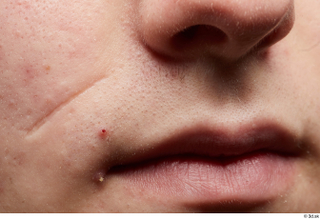 HD Face Skin Casey Schneider face lips mouth nose skin…